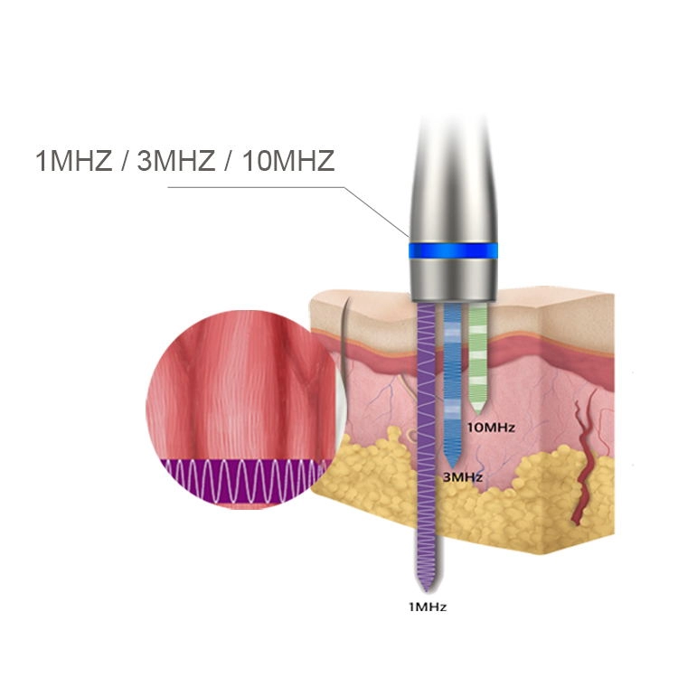 Ultradźwiękowa terapia LDM Noblesse 10 MHz 3 w 1 ultradźwiękowa zmarszczka grzechu usuń urządzenie kosmetyczne Sprzęt do pielęgnacji twarzy z falami ultradźwiękowymi o wysokiej częstotliwości